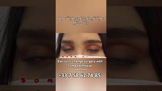 changing eye color without implant 💥Soma technique keratopigmentation eyecolorchange تجمیلالانف [upl. by Hawley]