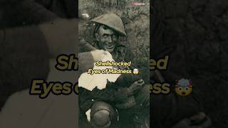 quotEyes of Madnessquot Soldier Shellshocked in World War I 😱 history ww1 soldier [upl. by Williamson]