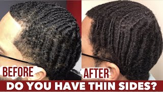 Hair Loss Causes for Men How to Stop Hair Loss Naturally amp Thicken Thinning Hair [upl. by Yumuk]