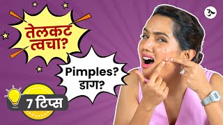 Acne Spot Removal  Oily Skin Moisturizer  Pimples Treatment at Home  Acne Scars Urmila Nimbalkar [upl. by Merrile]