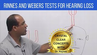 Rinnes and Webers Tests for Hearing Loss  ENT [upl. by Kristan798]