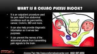 Celiac Plexus Block for Abdominal Pain Explained 602 5076550 [upl. by Amis957]