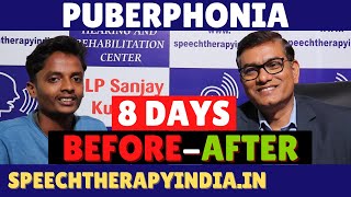 Unbelievable Voice Transformation in Just 8 Days  Puberphonia  SLPSanjayKumar  AIIMS Alumnus [upl. by Nirual]