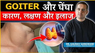 Important Things To Know About Thyroid Goiter  Dr Gaurav Gangwani Interventional Radiologist [upl. by Ninaj366]