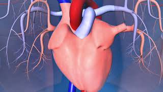 Catheter Ablation What is it and how does it help an irregular heart beat [upl. by Armat]