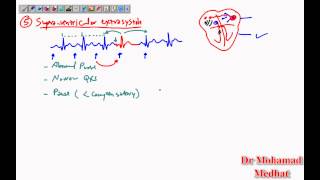 Arrhythmia ECG Dr Mohamad Medhat [upl. by Pricilla]