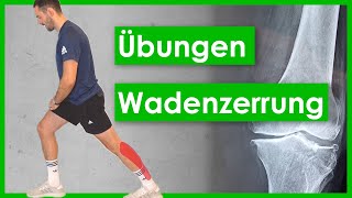 Wadenzerrung🦵Muskelfaserriss Übungen⎮RehaProgramm [upl. by Undry]