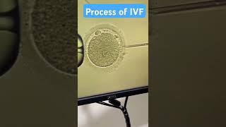 Process of IVF  Infertility process [upl. by Faubion210]