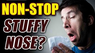 Cold  Effective Tips To Get Rid Of A Stuffy Nose  BoldSky [upl. by Hettie963]