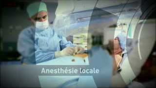 Radiologie interventionnelle  la gastrostomie [upl. by Lexie]