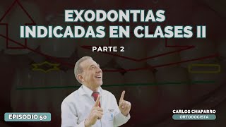 EXODONCIAS INDICADAS EN CLASES II 2 EXODONCIAS  PARTE 2  EPISODIO 50 [upl. by Ahselat]