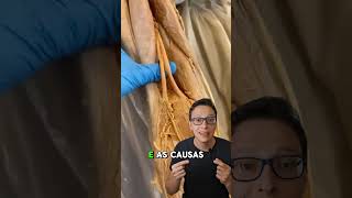 Nervo Ciático 😮🦵 curiosidades enfermagem medicina medico saude enfermeira anatomia ciatico [upl. by Irreg188]