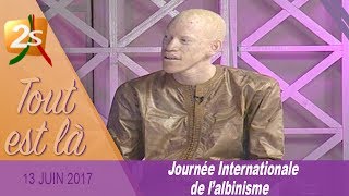 JOURNÉE DE LALBINISME LES PROBLÈMES RENCONTRÉS PAR LES ALBINOS AU SÉNÉGAL  TOUT EST LÀ DU 13 JUIN [upl. by Annuhsal]