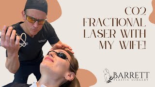 CO2 Fractional Laser Resurfacing With My Wife [upl. by Erdrich]