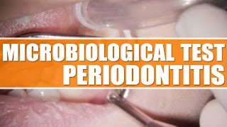 PERIODONTAL TREATMENT UK  Microbiological Test  Periodontitis [upl. by Nelrac308]