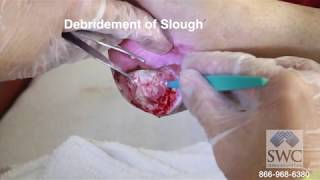 Explanation of Wound Dressings by Skilled Wound Care Dr Bardia Anvar MD [upl. by Nhar]