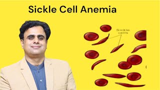 Sickle Cell Anemia [upl. by Niasuh]