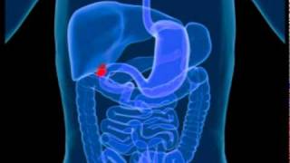 Gallbladder Disease  A Brief Look At Gallbladder Disease [upl. by Smeaj]