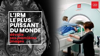 🧠Première mondiale Le cerveau dévoilé comme jamais grâce à l’IRM le plus puissant au monde [upl. by Esmond]