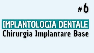 Implantologia Dentale  Chirurgia Implantare Semplice [upl. by Riella]