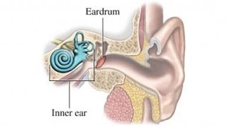 Meniere Disease [upl. by Gilpin]