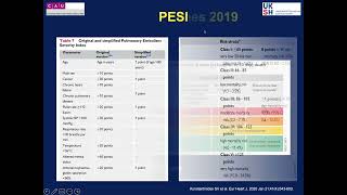 Thrombectomy in pulmonary embolism [upl. by Dellora]