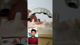 All in one metal ceramics capshortvideo dental new satisfying [upl. by Zerep284]