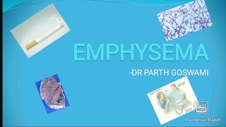 EMPHYSEMA  COMPLETE DISCUSSION  MCQs [upl. by Stauffer]