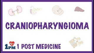 Craniopharyngioma [upl. by Yenffit]