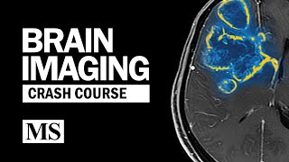 Brain Imaging Crash Course [upl. by Eenobe]