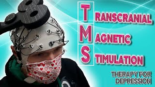 TMS For Depression  Basic Info How Well TMS Works Protocols Side Effects [upl. by Anigroeg]