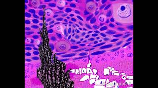 Starry NightBurkitts lymphoma animated Van Gogh pathology art [upl. by Wilbur]