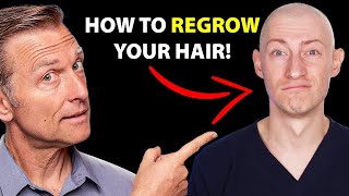 How to Regrow Your Hair UPDATED VITAL INFO  Hair Surgeon Reacts [upl. by Reeve]