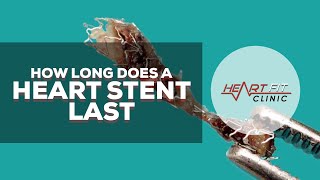 How long does a heart stent last [upl. by Athene]