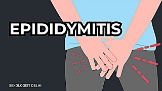 Epididymitis यह नामर्द बना देता है [upl. by Alper]