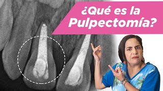 Pulpectomía ¿Qué es ¿Cuándo se debe hacer [upl. by Ahsoik]