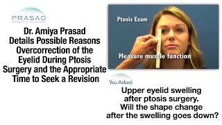 How Swelling after Ptosis Surgery Can Raise the Eyelid and the Right Time for Enhancement [upl. by Rosita101]