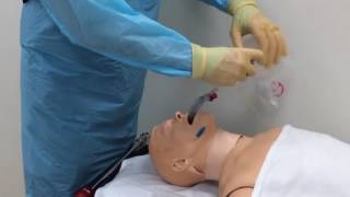 Intubation via the AirQ supraglottic airway [upl. by Pen]