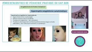 Indications de lamygdalectomie [upl. by Garald]