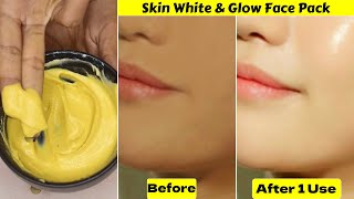 बेसन को ऐसे लगाओ For Permanent Skin Whitening ampGlowing Clear PigmentationSpots Brighten Dull Skin [upl. by Halet]