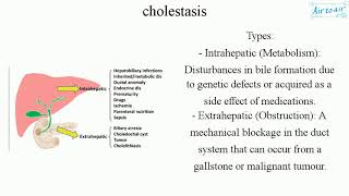 cholestasis [upl. by Ahsii]