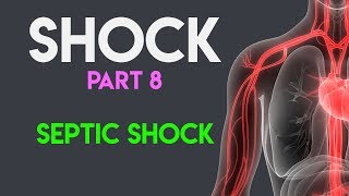 Septic Shock  Shock Part 8 [upl. by Ameehs827]