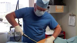 Dr Thomas Barnes LAUGHING THIGHS Tickle Lipo  Part I Newport Beach Ornage County [upl. by Jamie481]