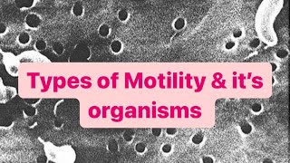 Types of Motility amp their organisms  Microbiology  MisMedicine [upl. by Tips]