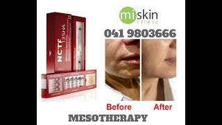 Filorga NCTF Mesotherapy [upl. by Ecnarepmet]