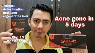 REVIEWING LIVERGUARD WITH SILYMARIN amp LECITHIN FOR LIVER DETOX amp ACNE OR PIMPLE REMOVER [upl. by Ovid]