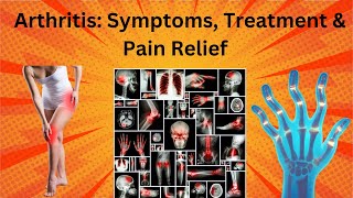 Arthritis symptoms treatment amp pain relief [upl. by Animas12]