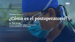 ¿Cómo es el postoperatorio de la Rinoplastia Ultrasónica [upl. by Solenne]