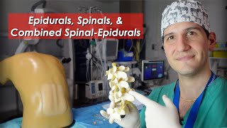 Epidural spinal and combined spinalepidural overview [upl. by Kenji]