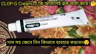 ClopG Cream এর কাজ কিদাম সহ জেনে নিন ব্যবহার করার নিয়ম  ফর্সা হওয়ার ক্রিম  ClopG Cream Review [upl. by Landahl]